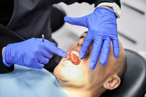Best Emergency Root Canal Treatment in Barker Heights, NC
